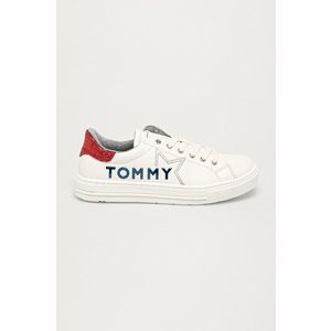 Tommy Hilfiger - Detské topánky vyobraziť