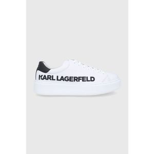 Kožená obuv Karl Lagerfeld čierna farba vyobraziť